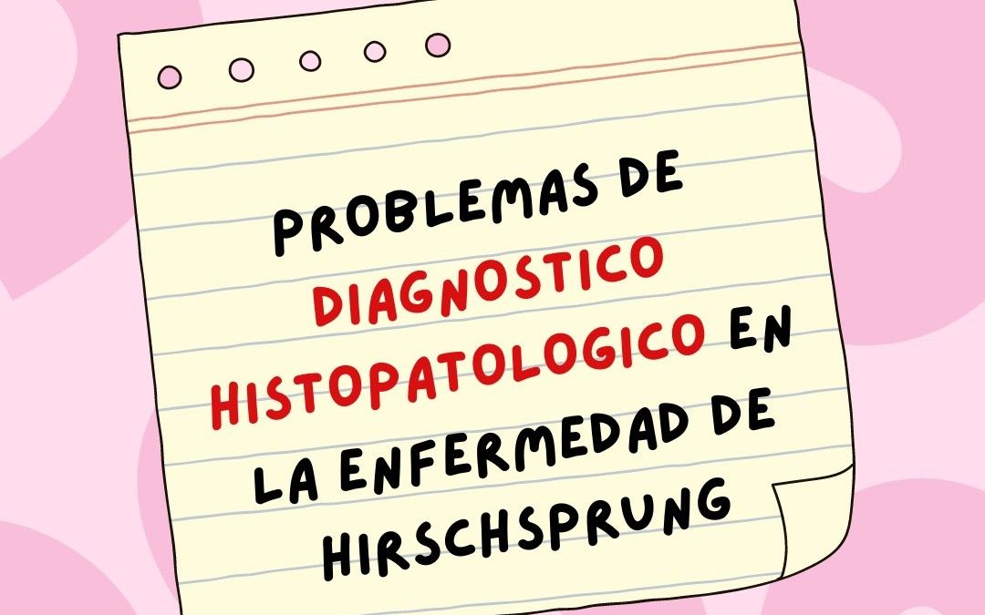 Problemas en el diagnóstico de la enfermedad de Hirschsprung