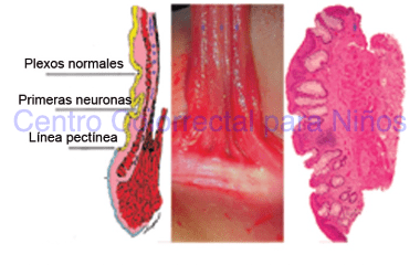 Perfecta localización para la toma de una biopsia de recto