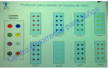 Esquema ilustrativo de una laminilla maestra