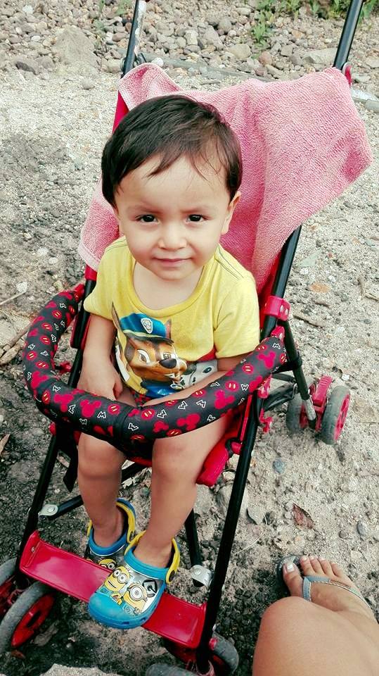 Testimonio niño con ileostomía sin enfermedad de Hirschsprung