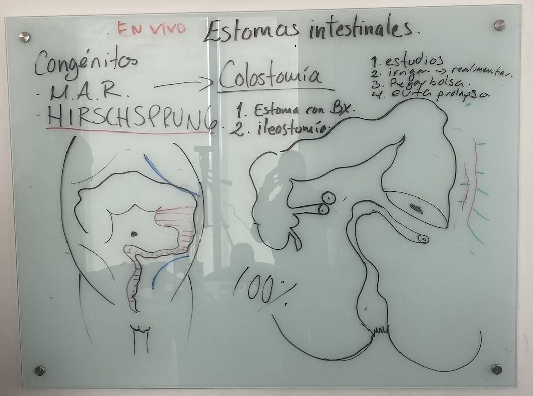 Resumen de la clase: "ileostomía y colostomía en niños"