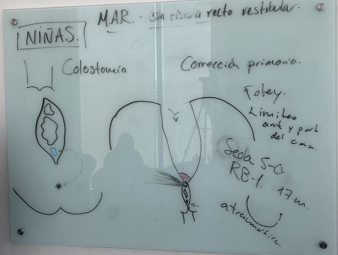Resumen de la clase: "malformación anorrectal con fístula recto vestibular"