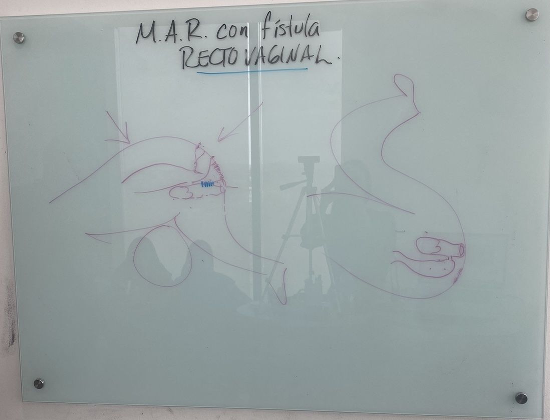 Resumen de la clase: "malformación anorrectal con fístula recto vaginal"