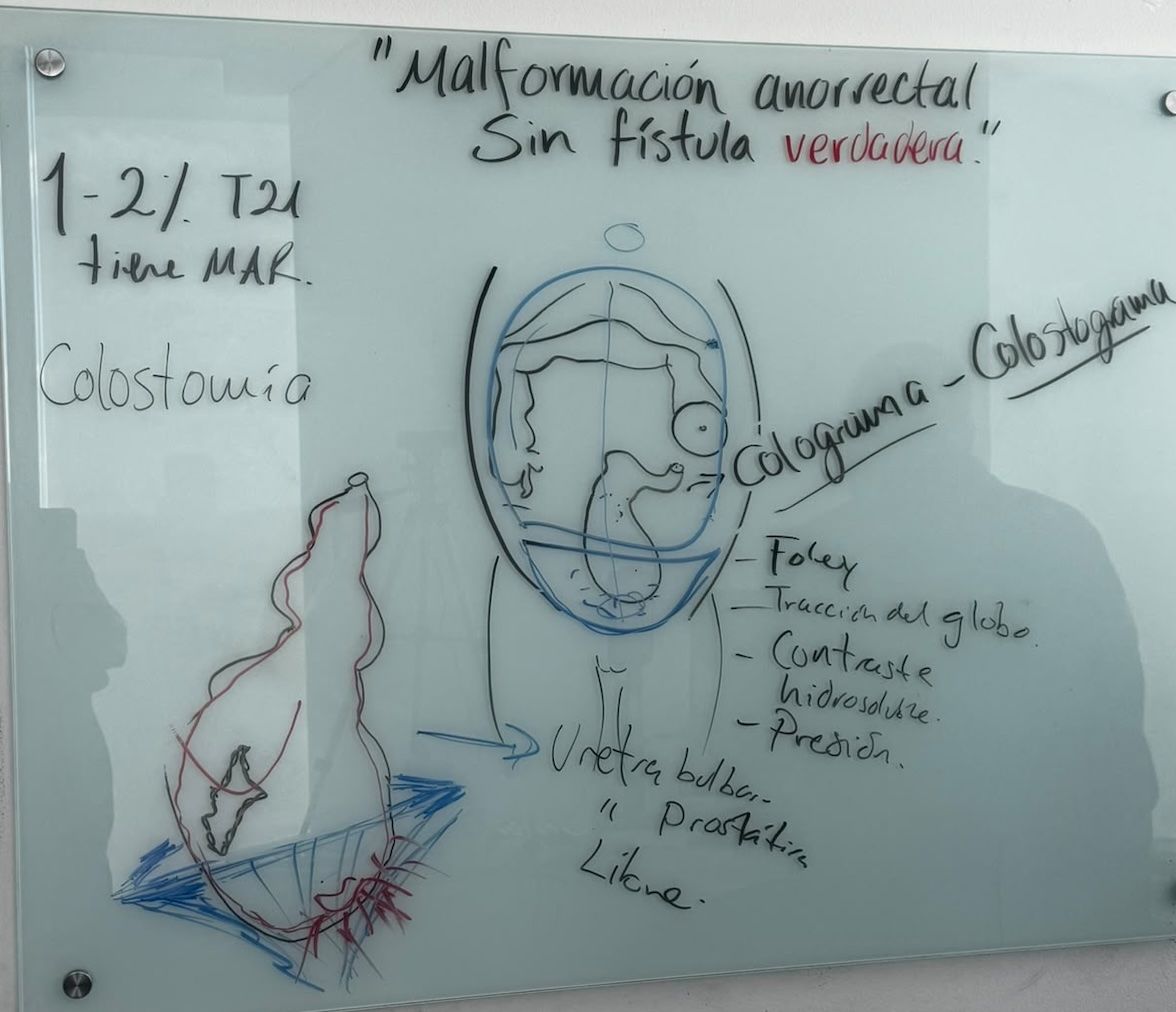 Resumen de la clase: "Malformación anorrectal sin fístula"
