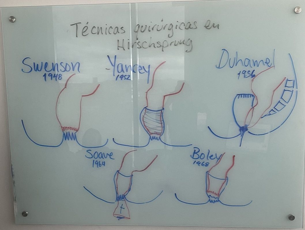 Resumen de la clase "técnicas quirúrgicas para la enfermedad de Hirschsprung" Resumen de la clase "técnicas quirúrgicas para la enfermedad de Hirschsprung"